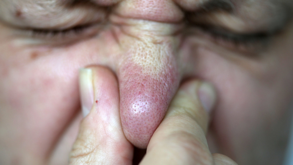 Was stinkt hier so? Anwohner in Offenbach haben Atemprobleme